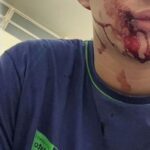 Adolescente de 15 anos é agredido dentro de sala de aula por colega e imagens repercutem