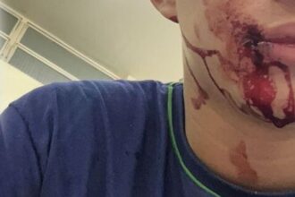 Adolescente de 15 anos é agredido dentro de sala de aula por colega e imagens repercutem